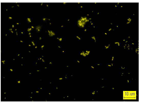 写真:微生物は蛍光色素で染まり明るい粒子として観察されます。対物レンズは40倍を使用、写真は約1,000倍に拡大しています。