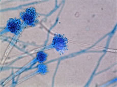 写真：もやもや状浮遊物の培養物の顕微鏡写真